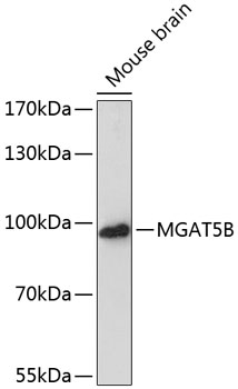 Western blot analysis of extracts of Mouse brain using MGAT5B Polyclonal Antibody at dilution of 1:3000.