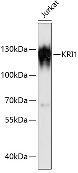 Western blot analysis of extracts of Jurkat cells using KRI1 Polyclonal Antibody at dilution of 1:3000.