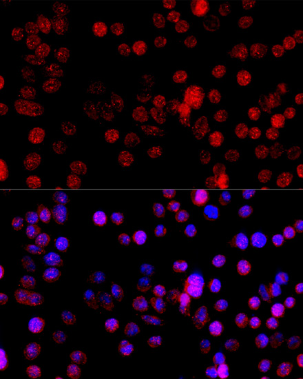 Immunofluorescence analysis of HeLa cells using CYP1B1 Polyclonal Antibody at dilution of  1:100 (40x lens). Blue: DAPI for nuclear staining.