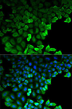 Immunofluorescence analysis of HeLa cells using G6PD Polyclonal Antibody