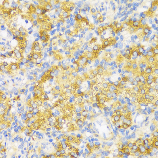 Immunohistochemistry of paraffin-embedded Rat ovary using HLA-DPB1 Polyclonal Antibody at dilution of  1:100 (40x lens).