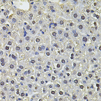 Immunohistochemistry of paraffin-embedded Mouse liver using SP110 Polyclonal Antibody at dilution of  1:100 (40x lens).