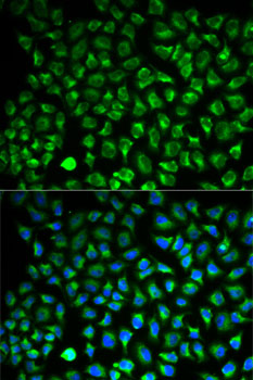 Immunofluorescence analysis of HeLa cells using MAOA Polyclonal Antibody