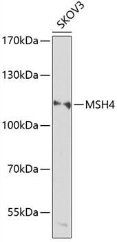 Western blot analysis of extracts of SKOV3 cells using MSH4 Polyclonal Antibody at dilution of 1:1000.
