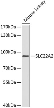 Western blot analysis of extracts of Mouse kidney using SLC22A2 Polyclonal Antibody at dilution of 1:1000.