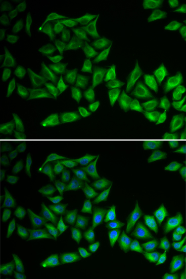 Immunofluorescence analysis of U2OS cells using TPMT Polyclonal Antibody