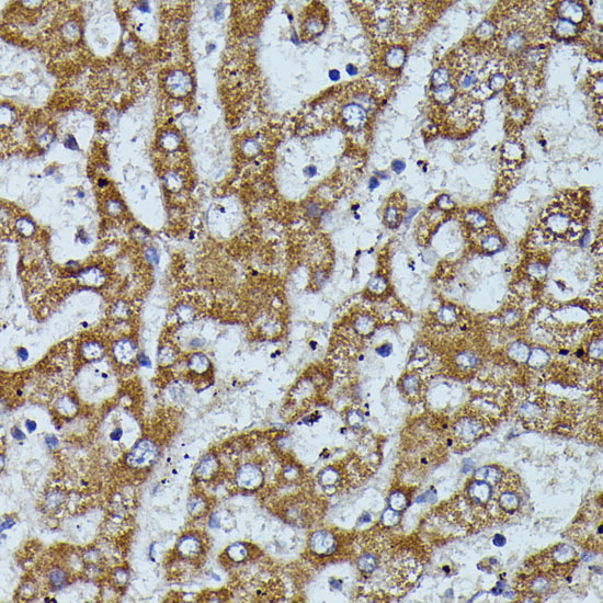 Immunohistochemistry of paraffin-embedded Human liver using APOC3 Polyclonal Antibody at dilution of  1:100 (40x lens).