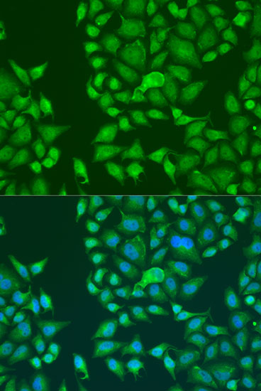 Immunofluorescence analysis of U2OS cells using STAU2 Polyclonal Antibody at dilution of  1:100. Blue: DAPI for nuclear staining.