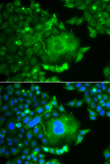 Immunofluorescence analysis of A549 cells using CACNG4 Polyclonal Antibody