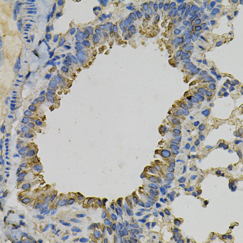 Immunohistochemistry of paraffin-embedded Mouse lung using PSAT1 Polyclonal Antibody at dilution of  1:100 (40x lens).