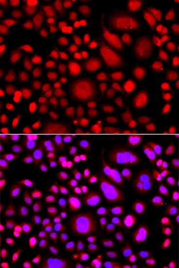 Immunofluorescence analysis of A549 cells using PRKAG3 Polyclonal Antibody
