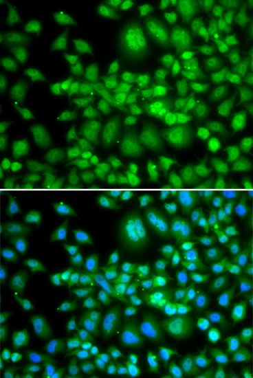 Immunofluorescence analysis of MCF-7 cells using SETD5 Polyclonal Antibody