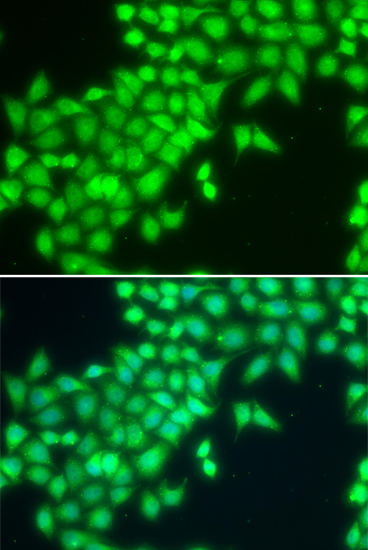 Immunofluorescence analysis of MCF-7 cells using METTL2A Polyclonal Antibody