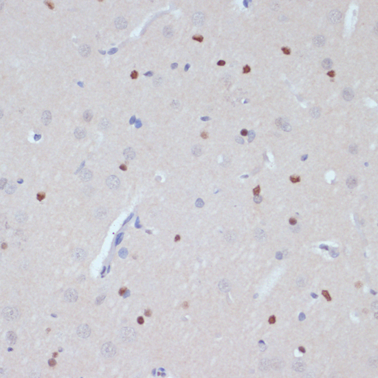 Immunohistochemistry of paraffin-embedded Rat brain using ESRRA Polyclonal Antibody at dilution of  1:200 (40x lens).