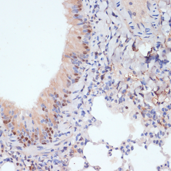 Immunohistochemistry of paraffin-embedded Mouse lung using ESRRA Polyclonal Antibody at dilution of  1:200 (40x lens).