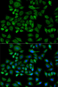 Immunofluorescence analysis of HeLa cells using HP Polyclonal Antibody