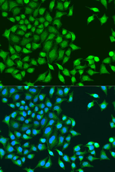 Immunofluorescence analysis of U2OS cells using RUVBL1 Polyclonal Antibody at dilution of  1:100. Blue: DAPI for nuclear staining.