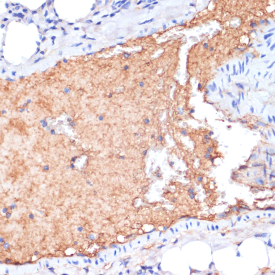 Immunohistochemistry of paraffin-embedded Mouse lung using APOA1 Polyclonal Antibody at dilution of  1:100 (40x lens).