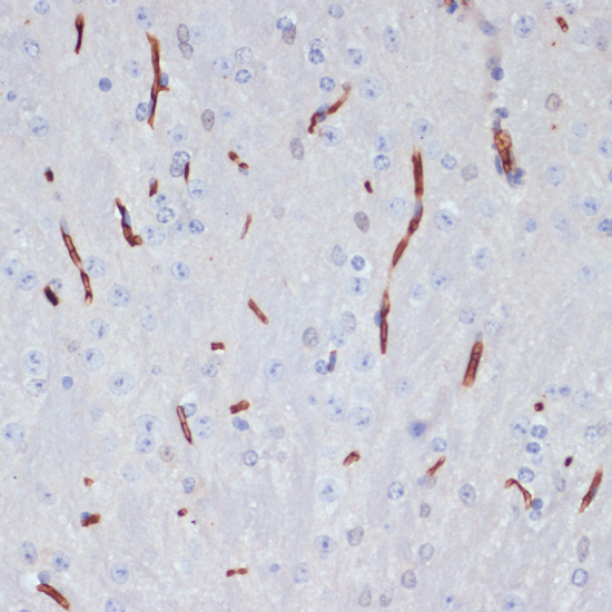 Immunohistochemistry of paraffin-embedded Mouse brain using APOA1 Polyclonal Antibody at dilution of  1:100 (40x lens).