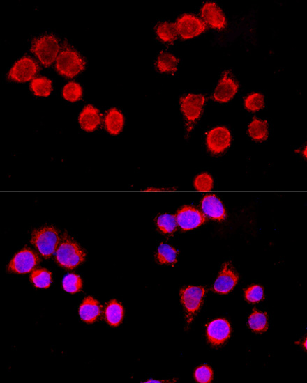 Immunofluorescence analysis of HeLa cells using CYP3A4 Polyclonal Antibody at dilution of  1:100 (40x lens). Blue: DAPI for nuclear staining.
