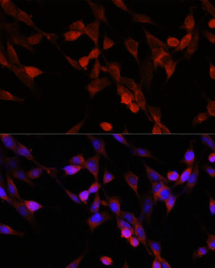 Immunofluorescence analysis of NIH/3T3 cells using UBIAD1 Polyclonal Antibody at dilution of  1:100. Blue: DAPI for nuclear staining.