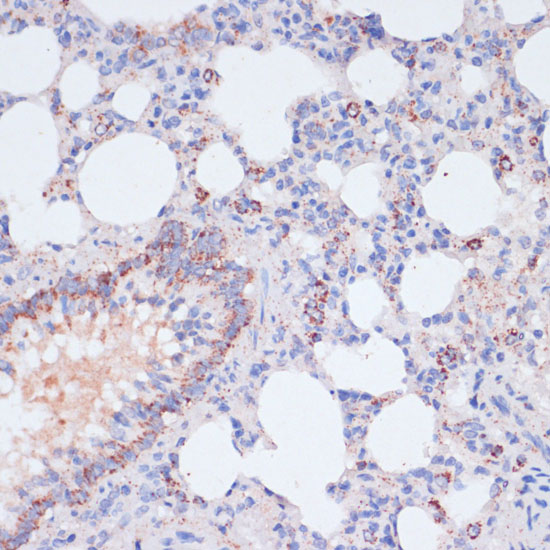 Immunohistochemistry of paraffin-embedded Rat lung using VASP Polyclonal Antibody at dilution of  1:100 (40x lens).