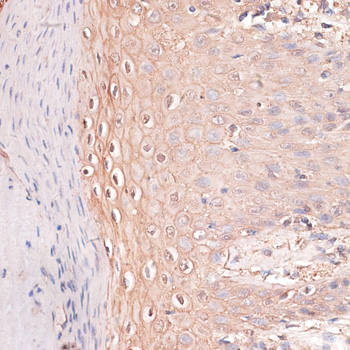Immunohistochemistry of paraffin-embedded Human skin using CDH3 Polyclonal Antibody at dilution of  1:100 (40x lens).