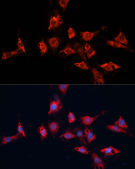 Immunofluorescence analysis of C6 cells using ADAM11 Polyclonal Antibody at dilution of  1:100. Blue: DAPI for nuclear staining.