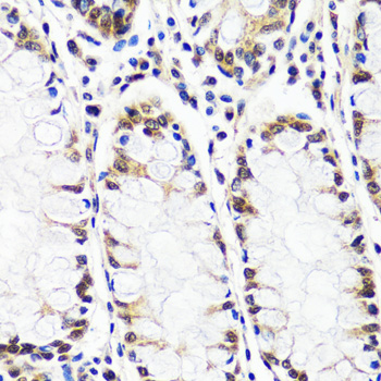 Immunohistochemistry of paraffin-embedded Human colon using CAND1 Polyclonal Antibody at dilution of  1:100 (40x lens).