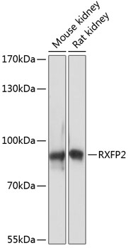 Western blot analysis of extracts of various cell lines using RXFP2 Polyclonal Antibody at dilution of 1:3000.
