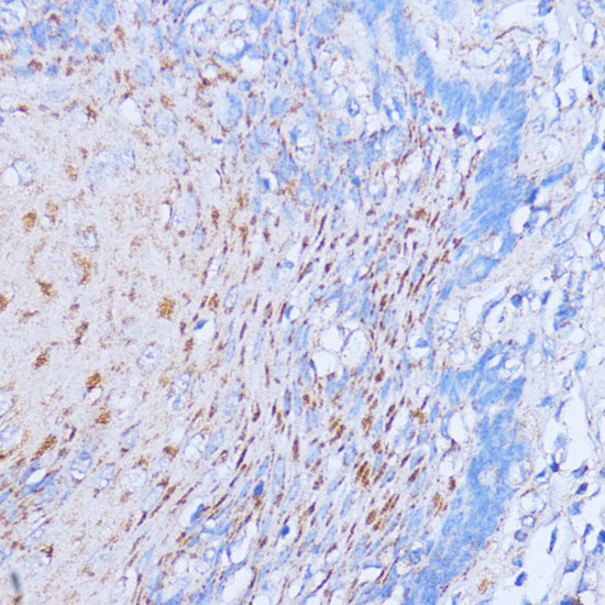 Immunohistochemistry of paraffin-embedded Human esophageal using NME6 Polyclonal Antibody at dilution of  1:100 (40x lens).