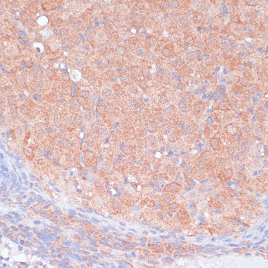 Immunohistochemistry of paraffin-embedded Rat ovary using LRP1 Polyclonal Antibody at dilution of  1:100 (40x lens).