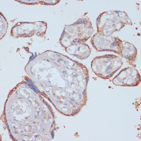 Immunohistochemistry of paraffin-embedded Human placenta using LRP1 Polyclonal Antibody at dilution of  1:100 (40x lens).