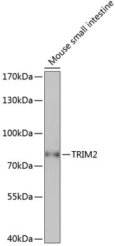 Western blot analysis of extracts of Mouse small intestine using TRIM2 Polyclonal Antibody at dilution of 1:1000.