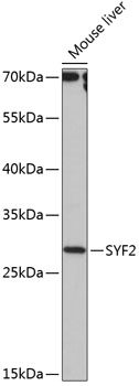 Western blot analysis of extracts of Mouse liver using SYF2 Polyclonal Antibody at dilution of 1:1000.