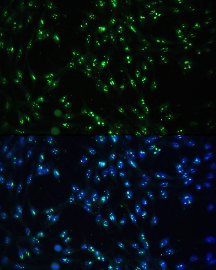 Immunofluorescence analysis of NIH-3T3 cells using CCDC59 Polyclonal Antibody at dilution of  1:100. Blue: DAPI for nuclear staining.