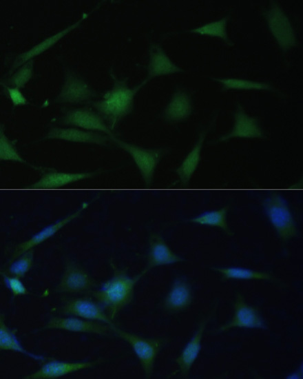 Immunofluorescence analysis of NIH-3T3 cells using p38 MAPK Polyclonal Antibody at dilution of  1:100. Blue: DAPI for nuclear staining.