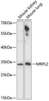 Western blot analysis of extracts of various cell lines using MRPL2 Polyclonal Antibody at dilution of 1:1000.