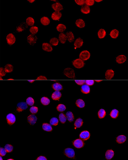 Immunofluorescence analysis of HeLa cells using CYP11B2 Polyclonal Antibody at dilution of  1:100 (40x lens). Blue: DAPI for nuclear staining.
