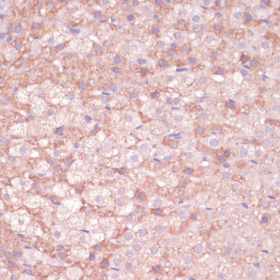 Immunohistochemistry of paraffin-embedded Rat adrenal gland using CYP11B2 Polyclonal Antibody at dilution of  1:100 (40x lens).