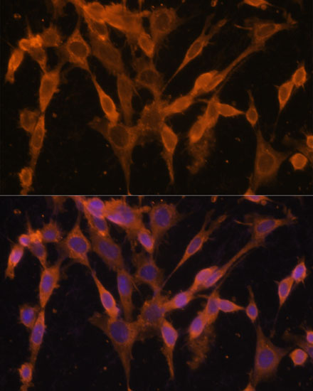 Immunofluorescence analysis of NIH/3T3 cells using UBQLNL Polyclonal Antibody at dilution of  1:100. Blue: DAPI for nuclear staining.