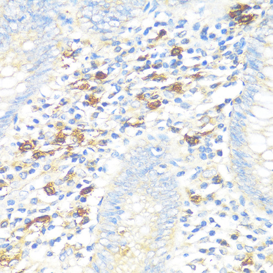 Immunohistochemistry of paraffin-embedded Human appendix using TPSAB1 Polyclonal Antibody at dilution of  1:100 (40x lens).