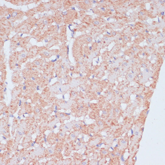 Immunohistochemistry of paraffin-embedded Rat heart using MZB1 Polyclonal Antibody at dilution of  1:100 (40x lens).