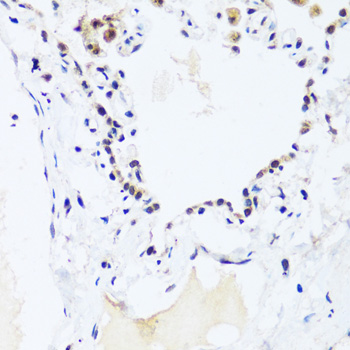 Immunohistochemistry of paraffin-embedded Human lung using BRIX1 Polyclonal Antibody at dilution of  1:100 (40x lens).