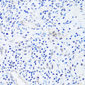 Immunohistochemistry of paraffin-embedded Human appendix using BRIX1 Polyclonal Antibody at dilution of  1:100 (40x lens).