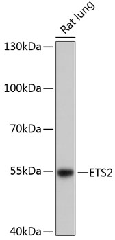 Western blot analysis of extracts of Rat lung using ETS2 Polyclonal Antibody at dilution of 1:3000.