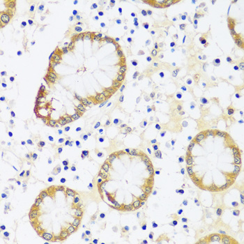 Immunohistochemistry of paraffin-embedded Human stomach using CAMK1 Polyclonal Antibody at dilution of  1:100 (40x lens).
