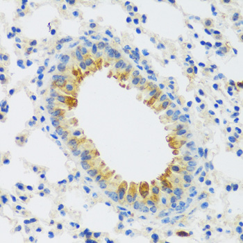 Immunohistochemistry of paraffin-embedded Mouse lung using CAMK1 Polyclonal Antibody at dilution of  1:100 (40x lens).