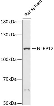 Western blot analysis of extracts of Rat spleen using NLRP12 Polyclonal Antibody at dilution of 1:3000.