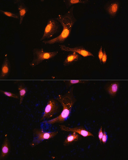 Immunofluorescence analysis of U2OS cells using FLCN Polyclonal Antibody at dilution of  1:100. Blue: DAPI for nuclear staining.
